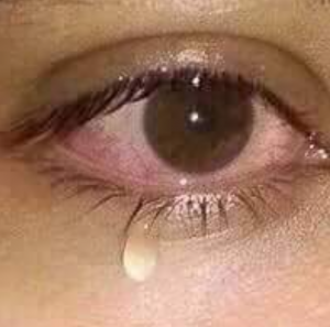 কান্না করা পিক